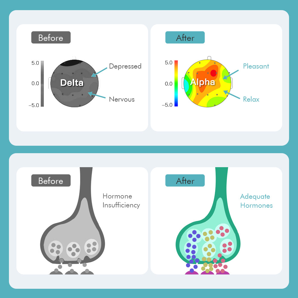 CES Insomnia Relaxer Sleep Aid Device – Electrotherapy Machine for Anxiety, Stress, and Depression Relief – Portable Health Equipment for Natural Sleep & Mental Wellness